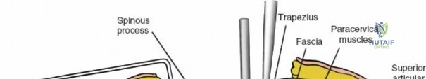 Clinical Image