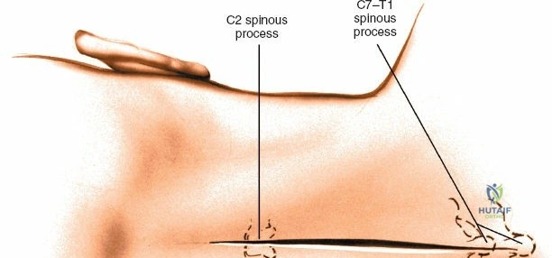 Clinical Image