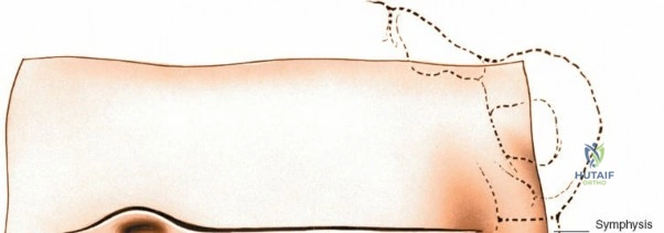 Clinical Image