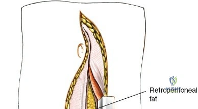 Clinical Image