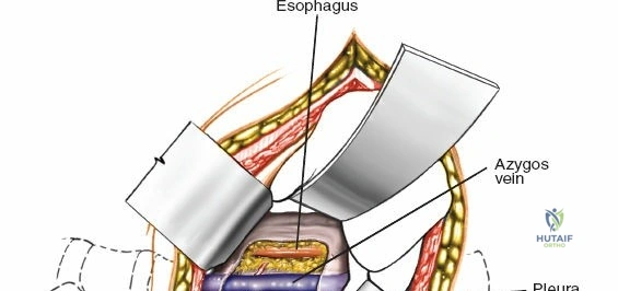 Clinical Image