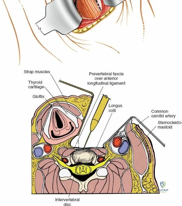 Clinical Image