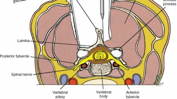 Clinical Image