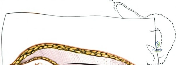 Clinical Image