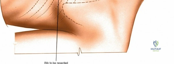 Clinical Image