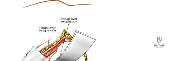 Clinical Image
