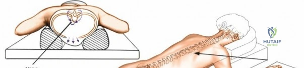 Clinical Image