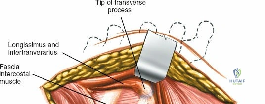 Clinical Image