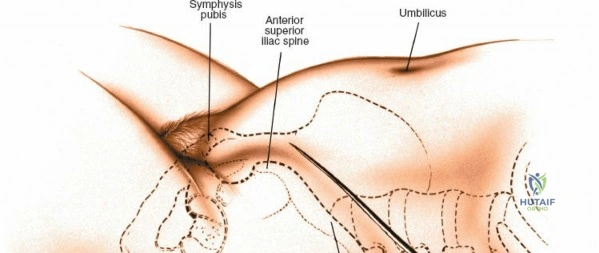 Clinical Image