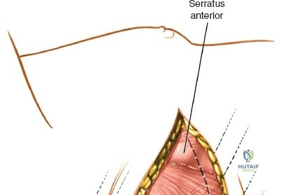 Clinical Image