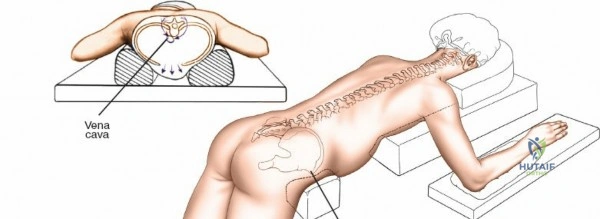 Clinical Image
