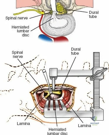 Clinical Image