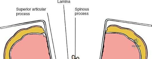Clinical Image