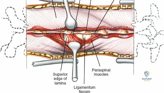 Clinical Image