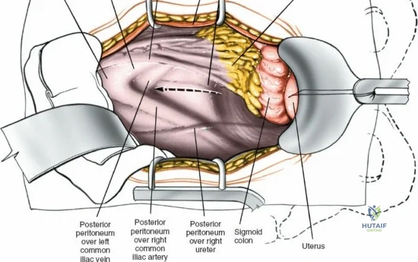 Clinical Image