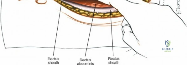 Clinical Image