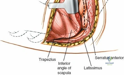 Clinical Image