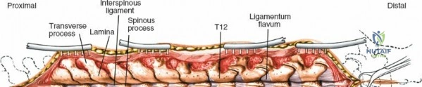 Clinical Image