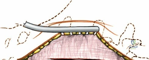 Clinical Image