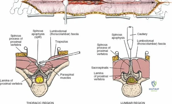Clinical Image