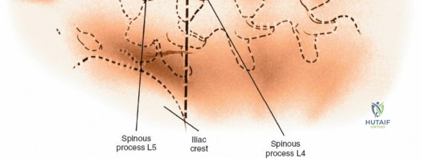 Clinical Image
