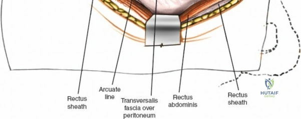 Clinical Image