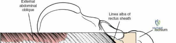 Clinical Image