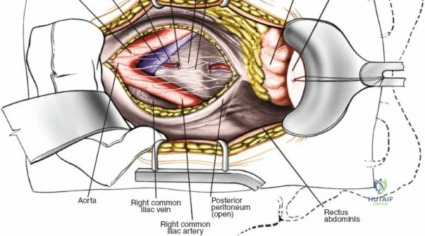 Clinical Image