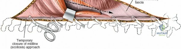 Clinical Image