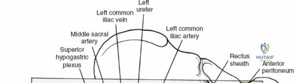 Clinical Image