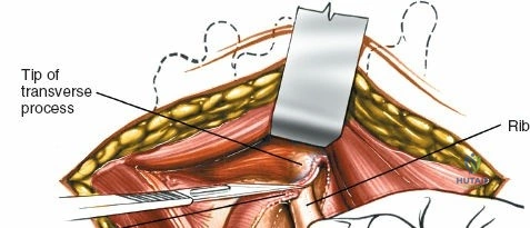Clinical Image
