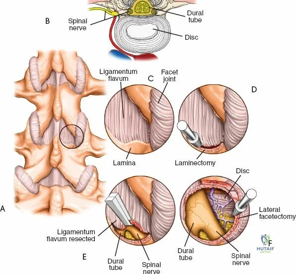 Clinical Image