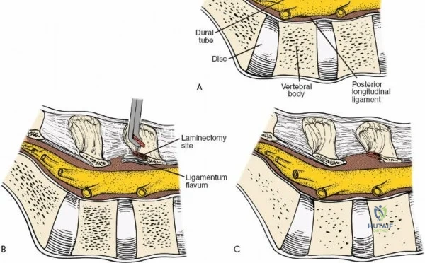 Clinical Image