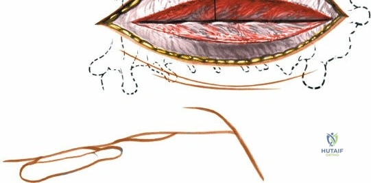 Clinical Image