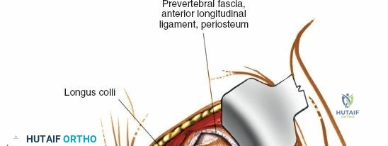 Clinical Image