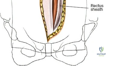 Clinical Image