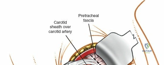 Clinical Image