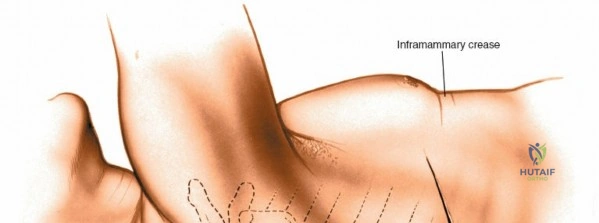 Clinical Image