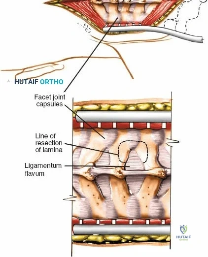 Clinical Image