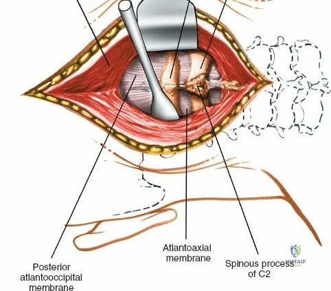Clinical Image