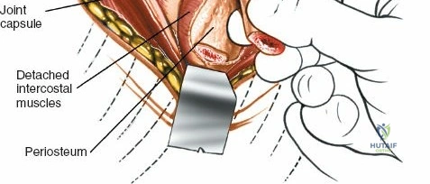 Clinical Image