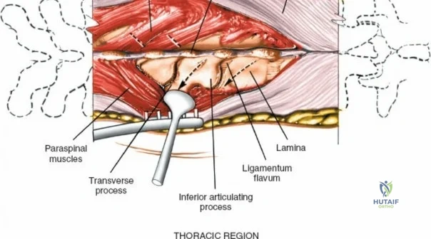 Clinical Image