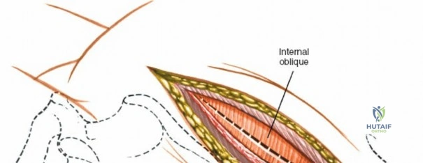 Clinical Image