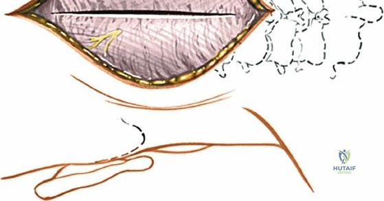 Clinical Image