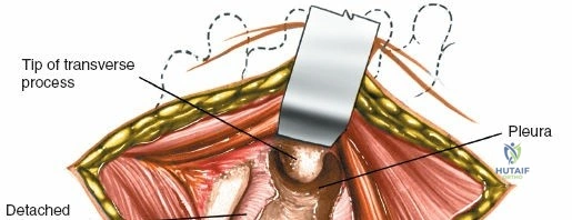 Clinical Image
