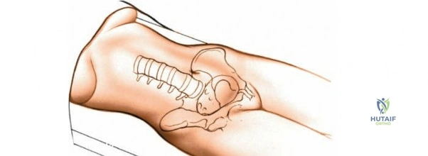 Clinical Image