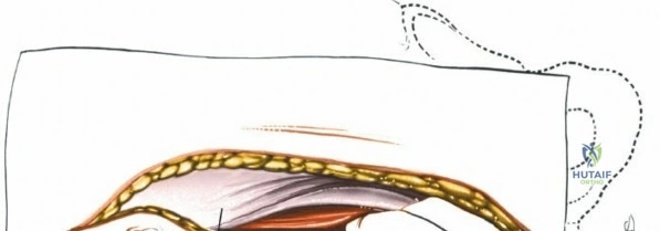 Clinical Image
