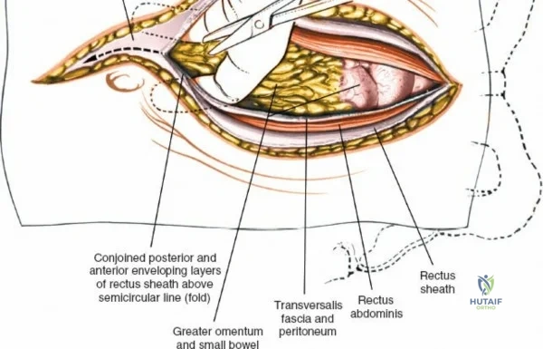 Clinical Image