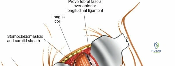 Clinical Image