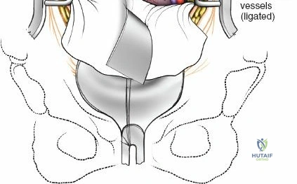 Clinical Image